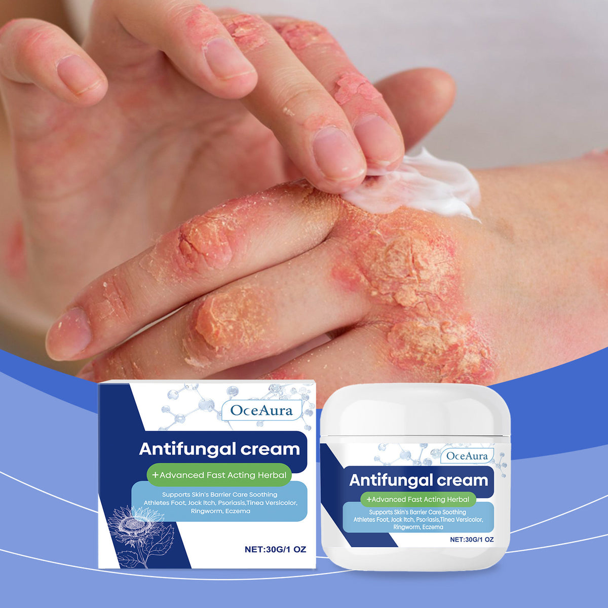 Skin Repair Cream Repairs and Nourishes Body Skin  Moisturizing Care