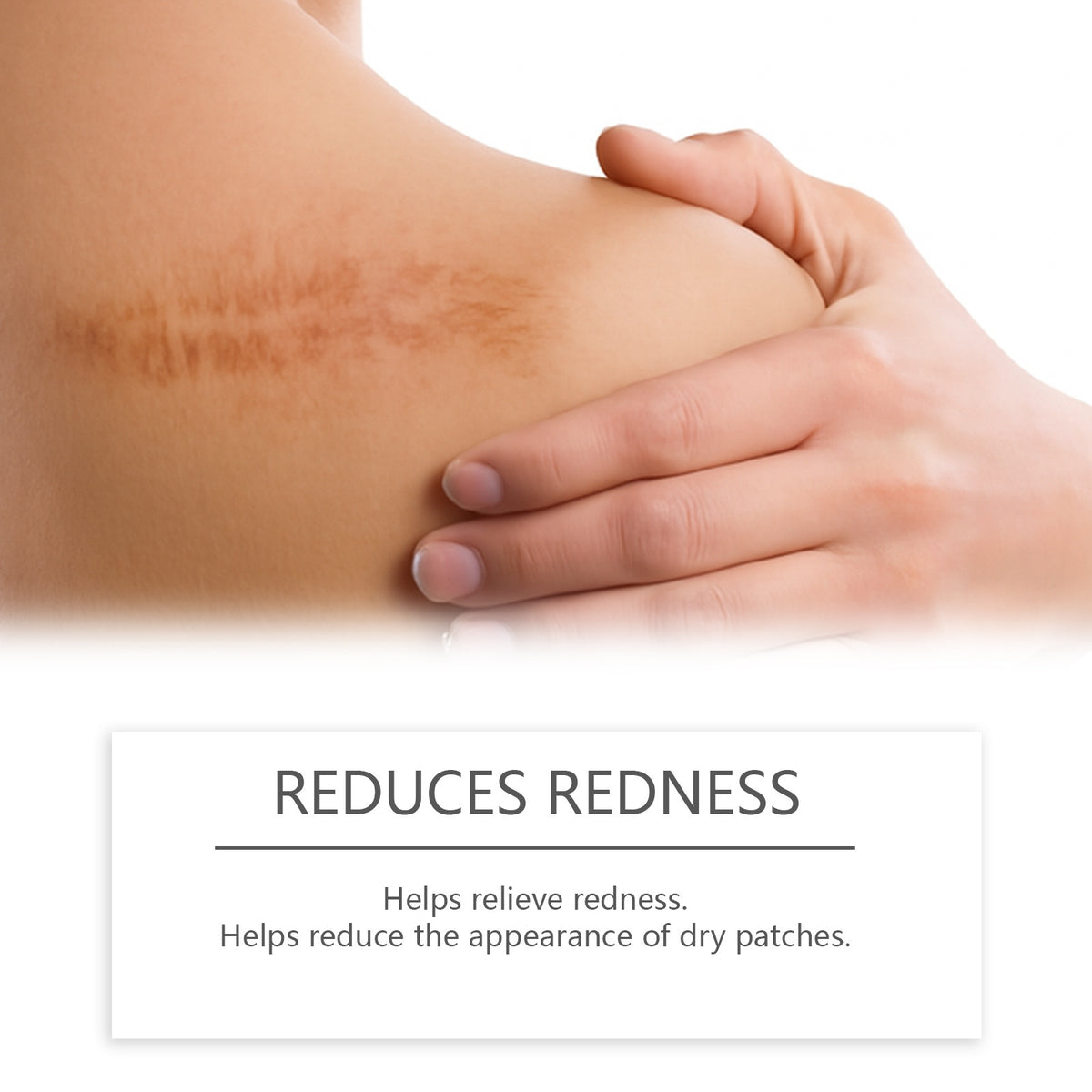 Skin Scar Moisturizing Care Stick