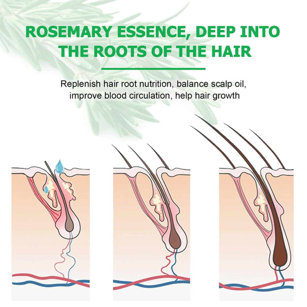 Rosemary Hair Growth Scalp Treatment Oil