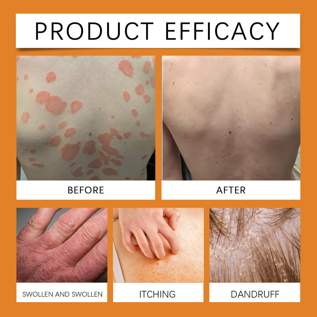 Bee Venom Moisturizing Skin Care Cream