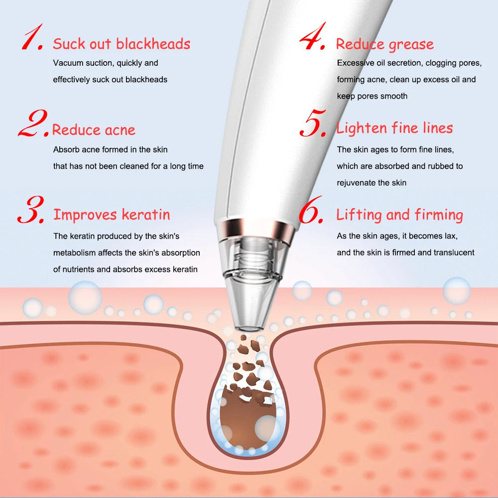 Electric Blackhead Remover Skin Cleaner